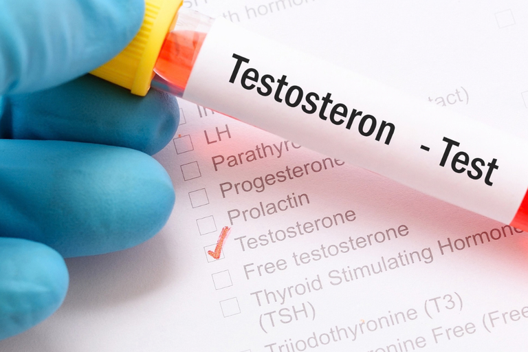 Testosteron in de overgang I FemmePrex